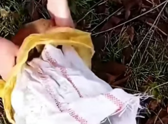 A kind girl rescues a dog thrown away in a sack and then…… #rescu…